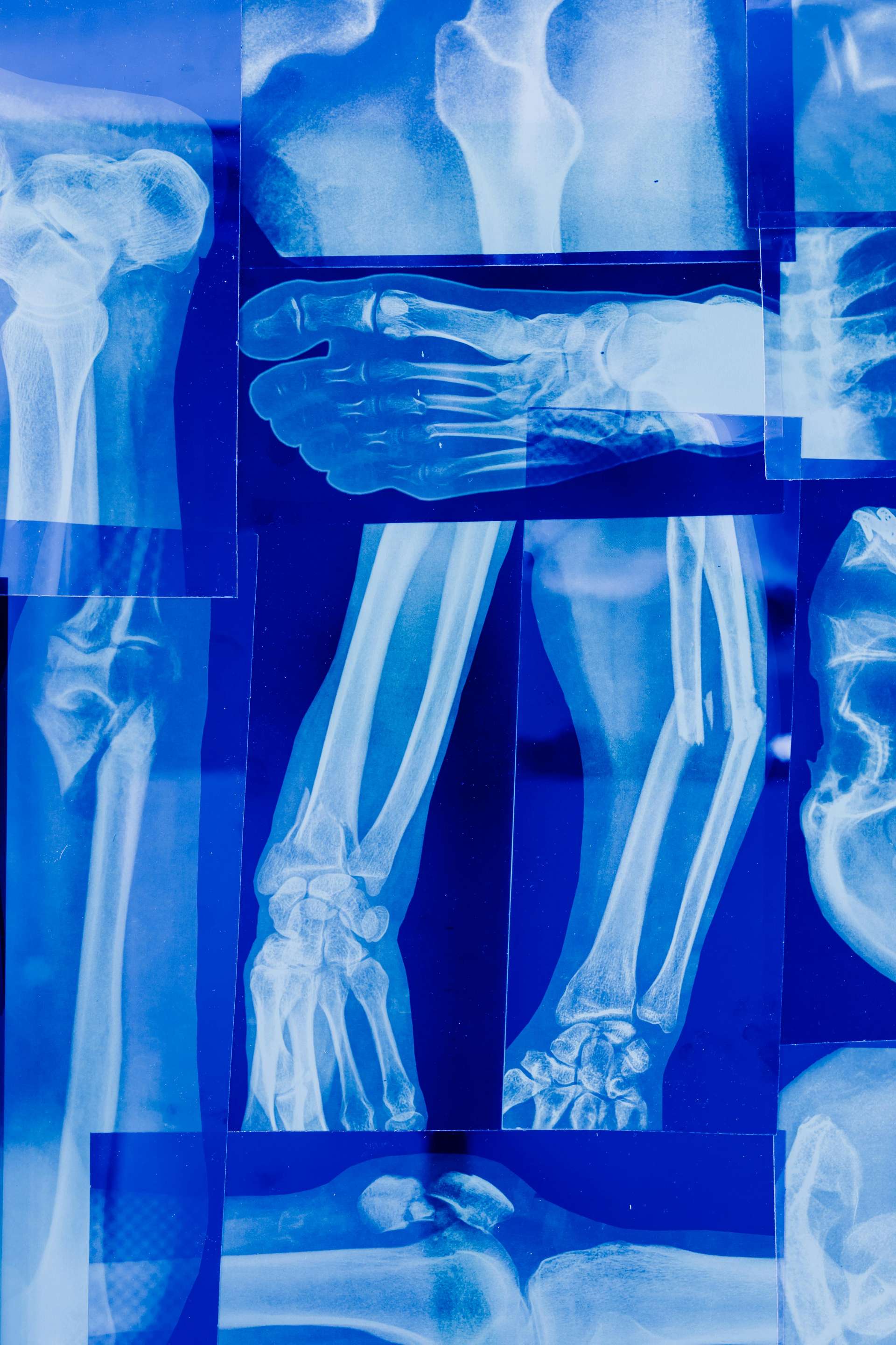 Why Egypt Is Becoming a Global Leader in Orthopedic Surgery